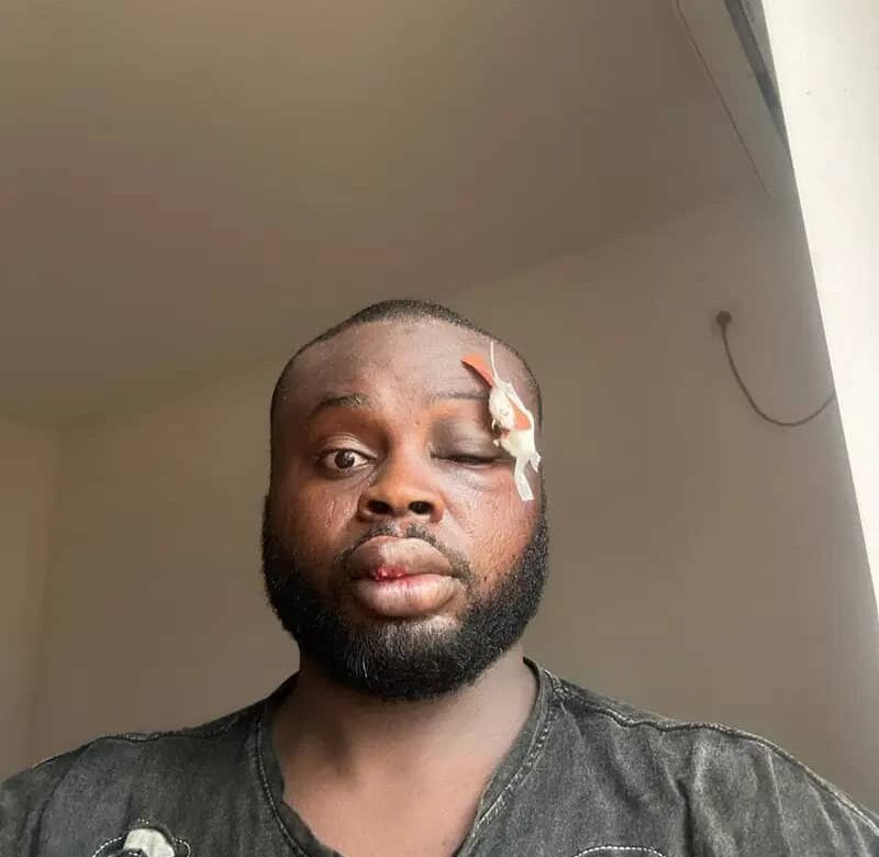 Organ harvesters lures Imo- born, kills him in Thailand 