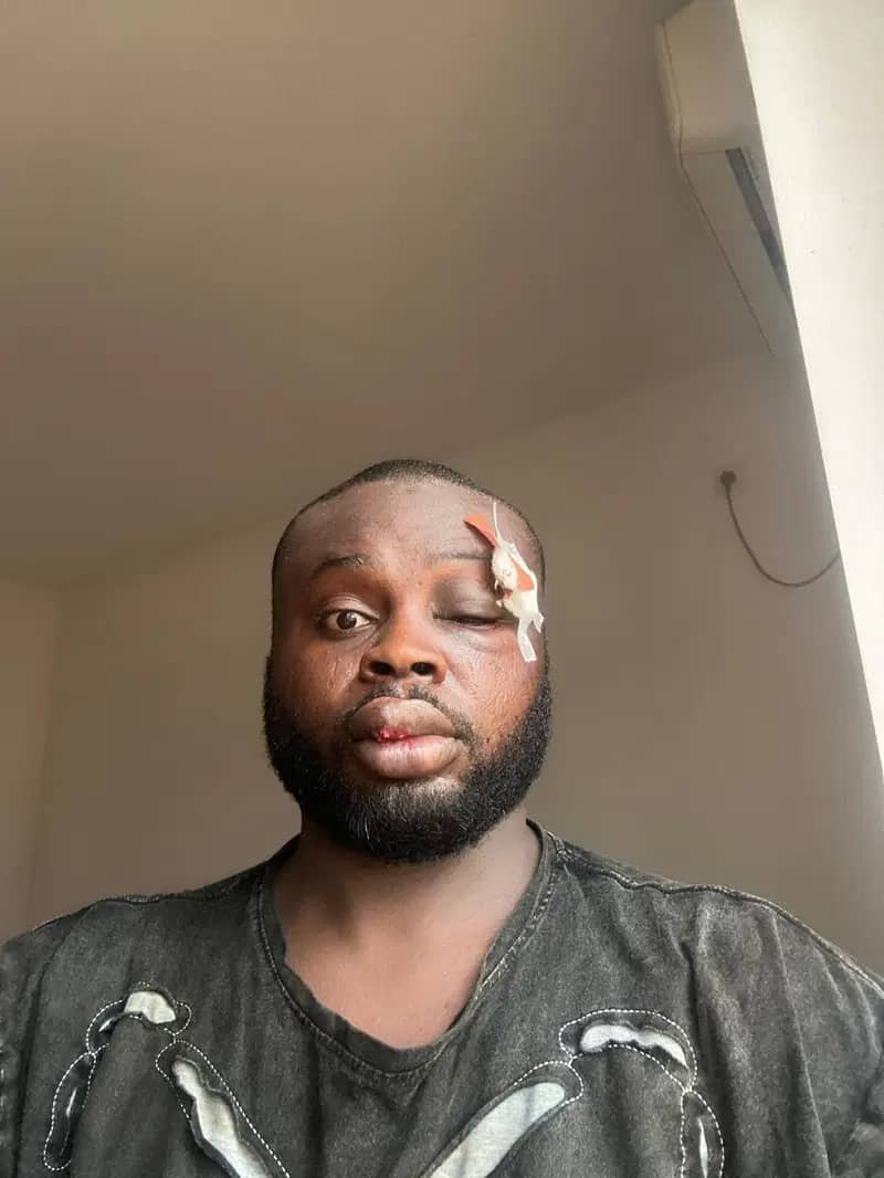 Organ harvesters lures Imo- born, kills him in Thailand 